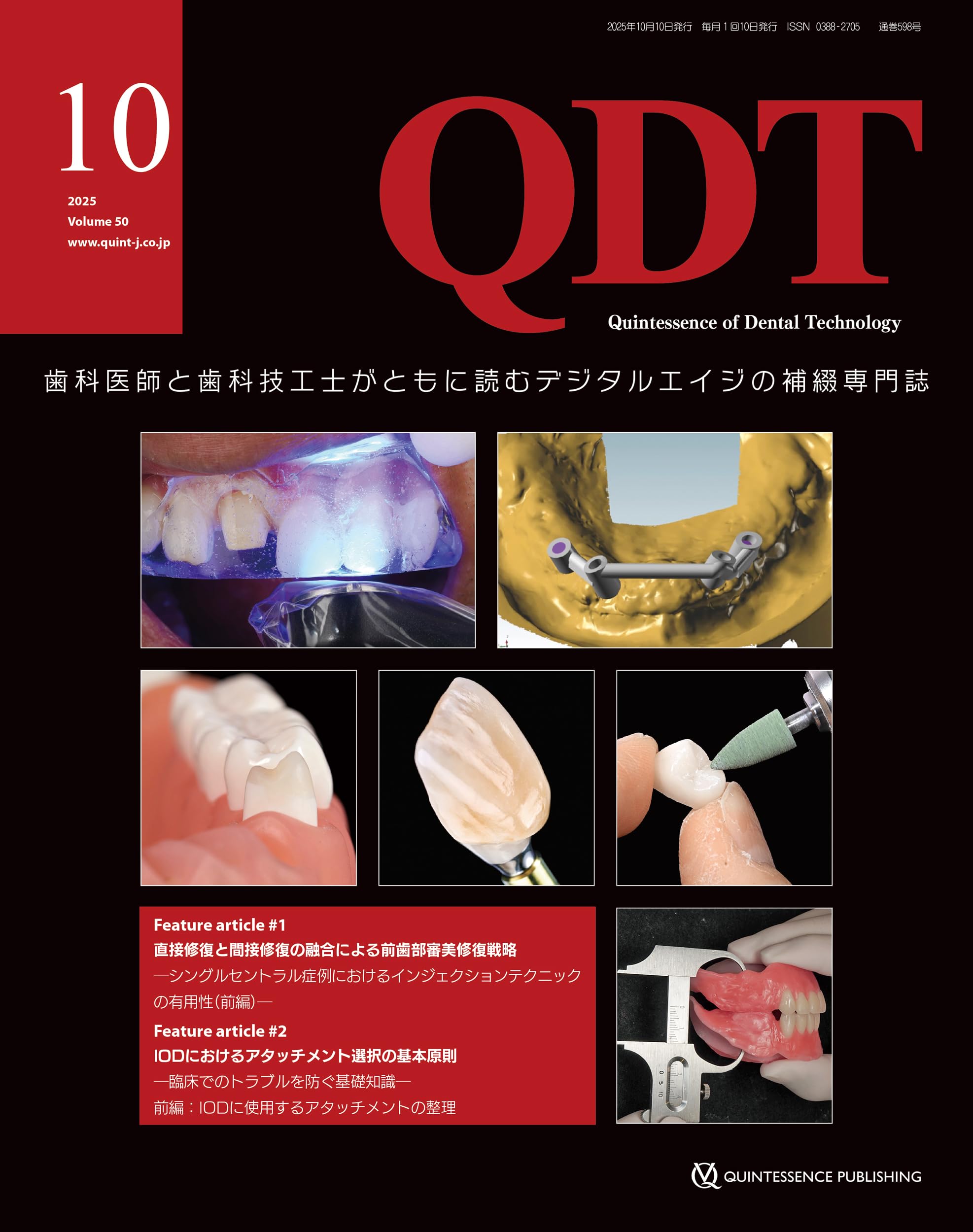 QDT 2025年10月号: 歯科医師と歯科技工士がともに読むデジタルエイジの